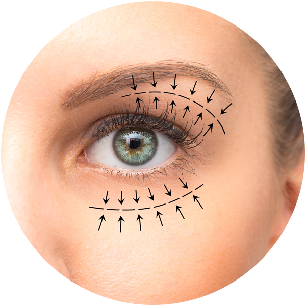BellaNova_Bleferoplastie_CO2_541