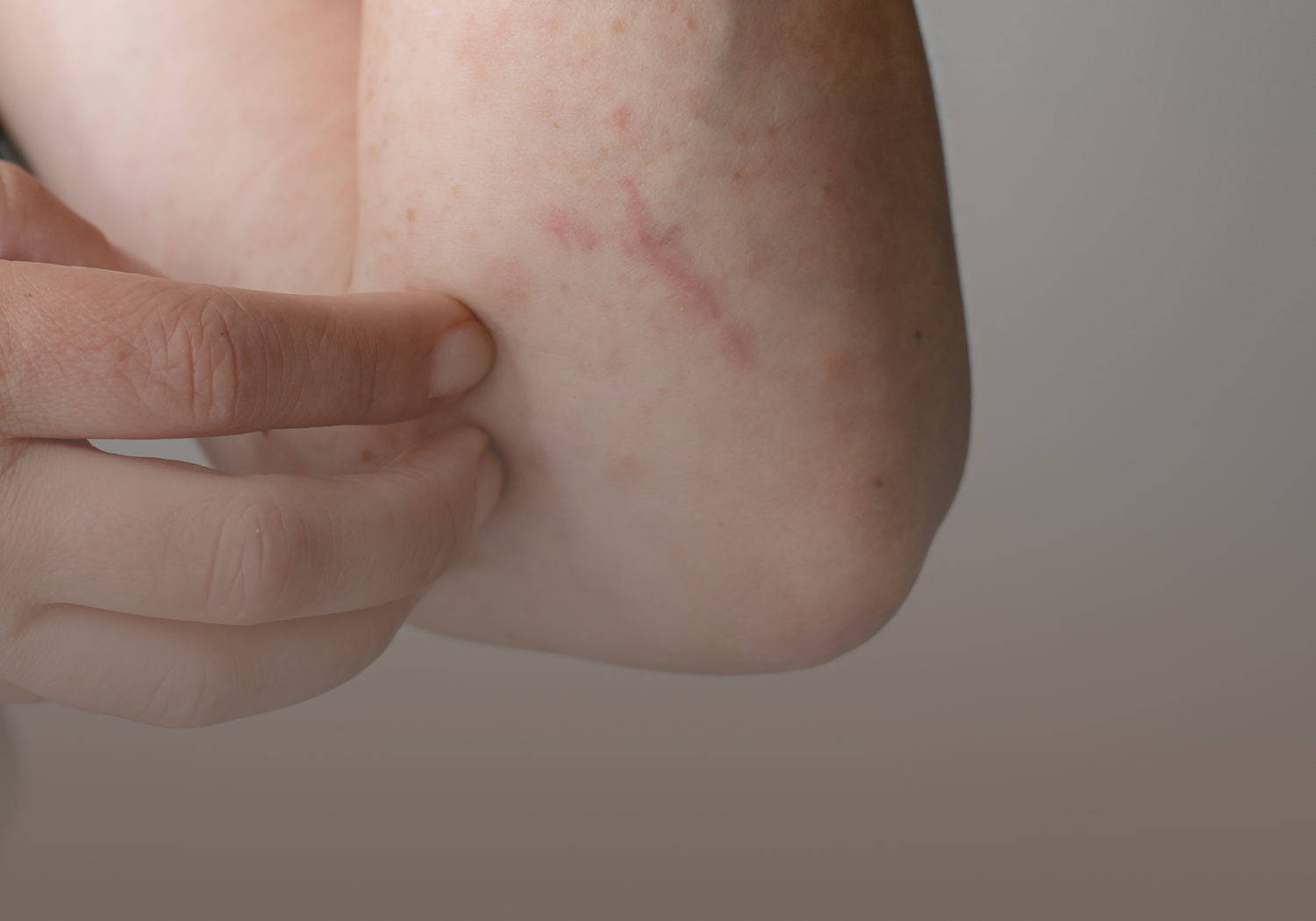 Bacterial_Diseases_555