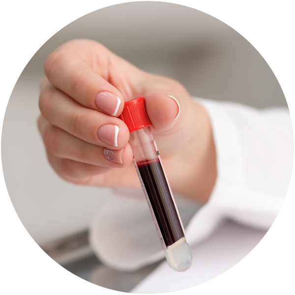 BellaNova_Blood_tests_541