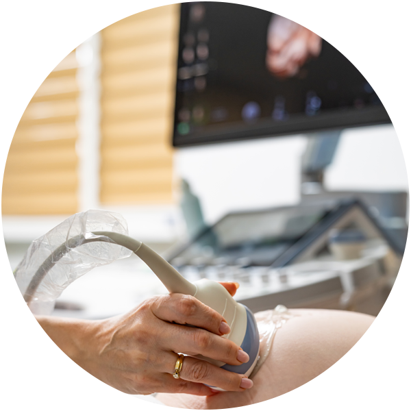 BellaNova_Gynecological_Ultrasound_541