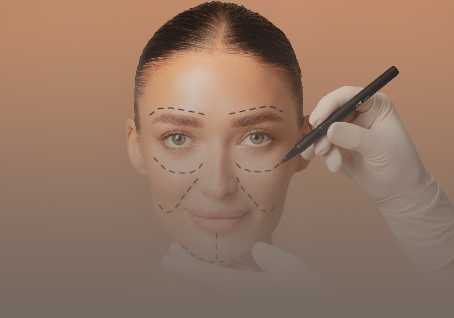 Facelift_555