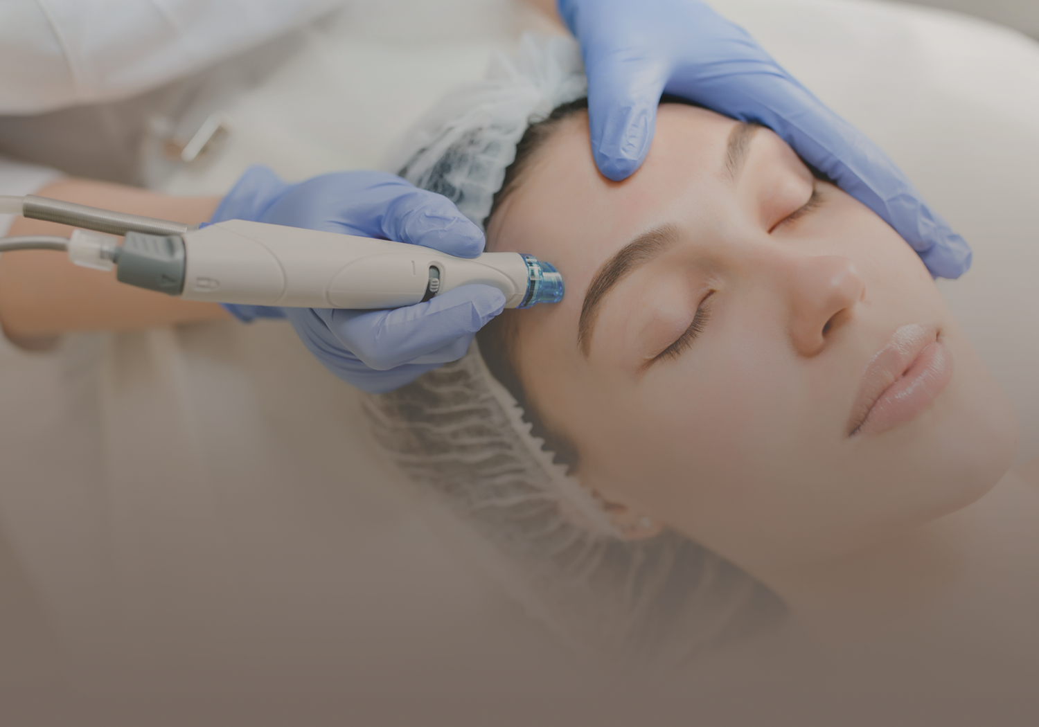 Laser_Skin_Resurfacing_555