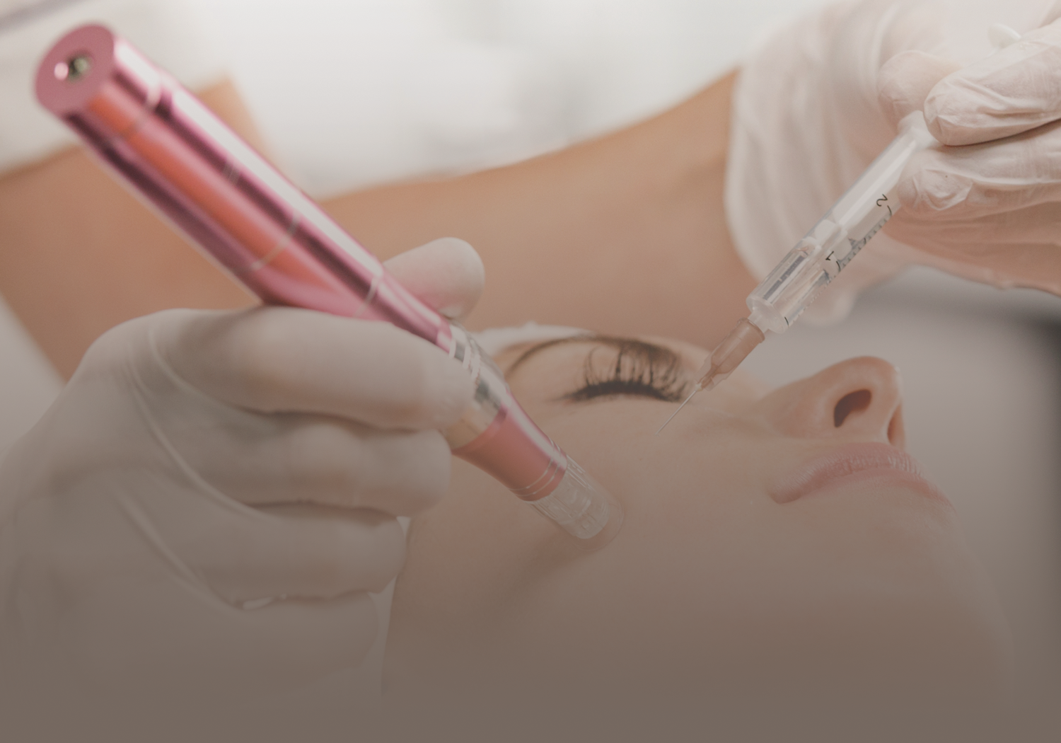 Microneedling_with_Dermapen_555