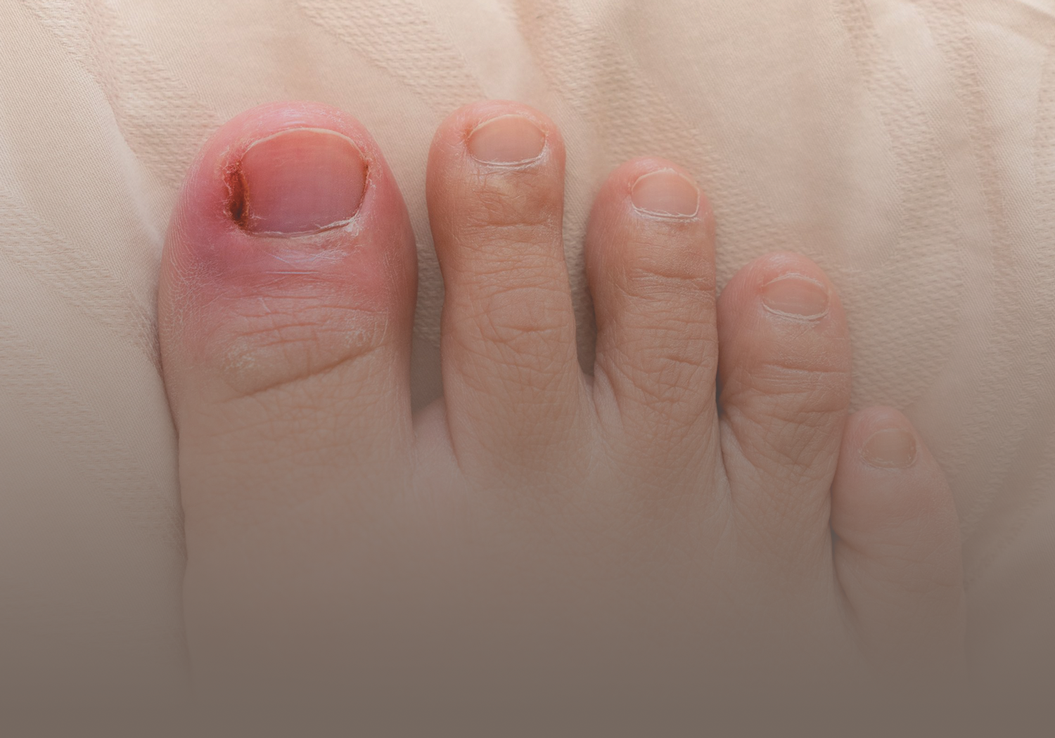 Service_Ingrown_Toenails_444