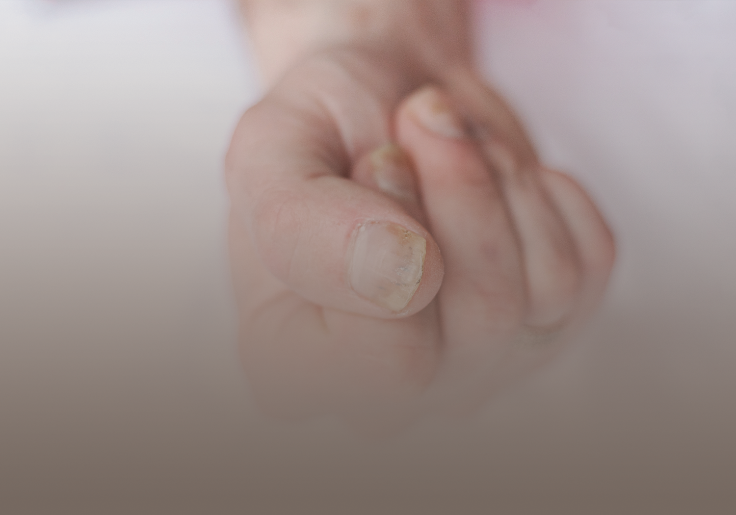 Service_Nail_Fungus_533