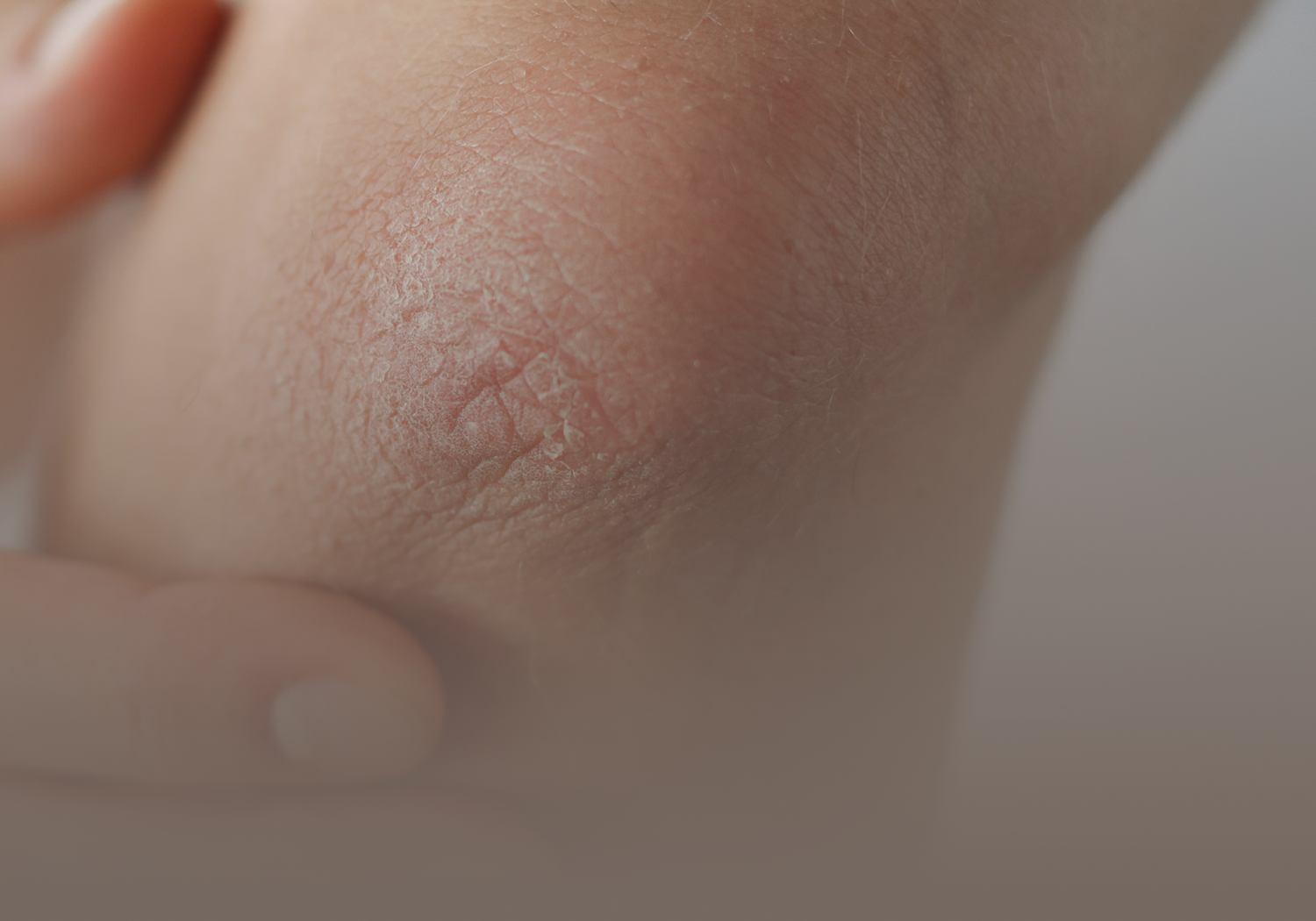 Service_Skin_Mycoses_3822