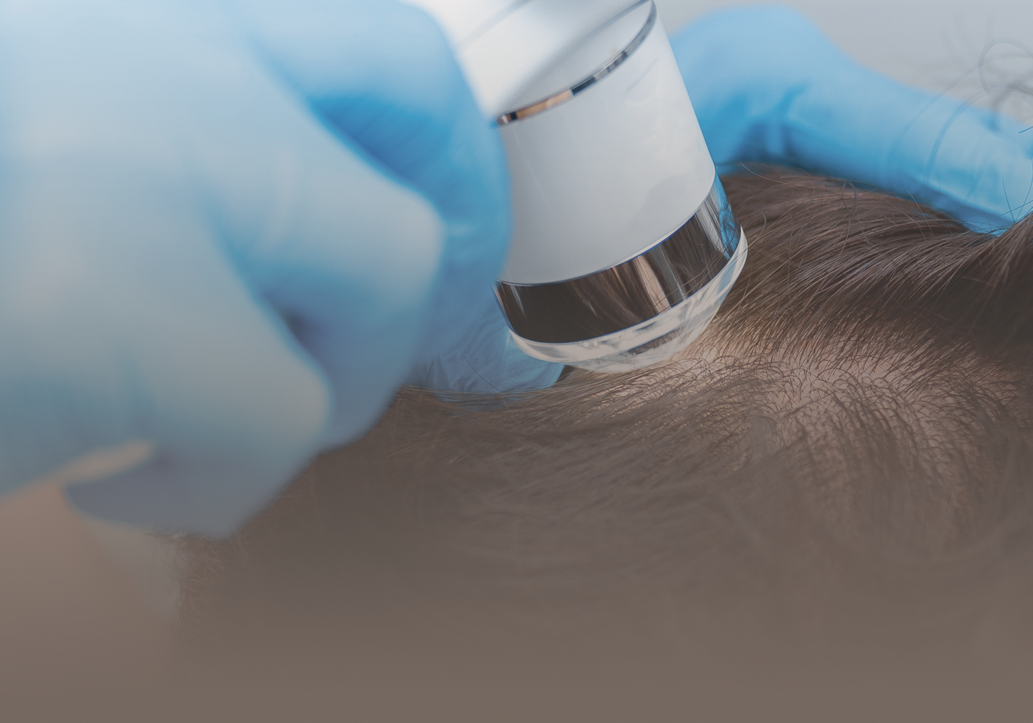 Service_anti-hair_loss_454
