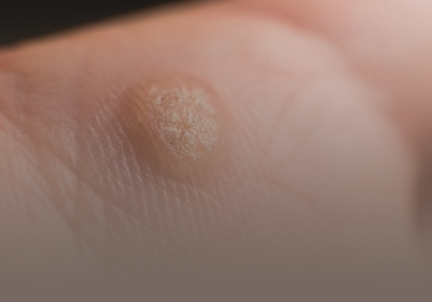 Service_warts_4323